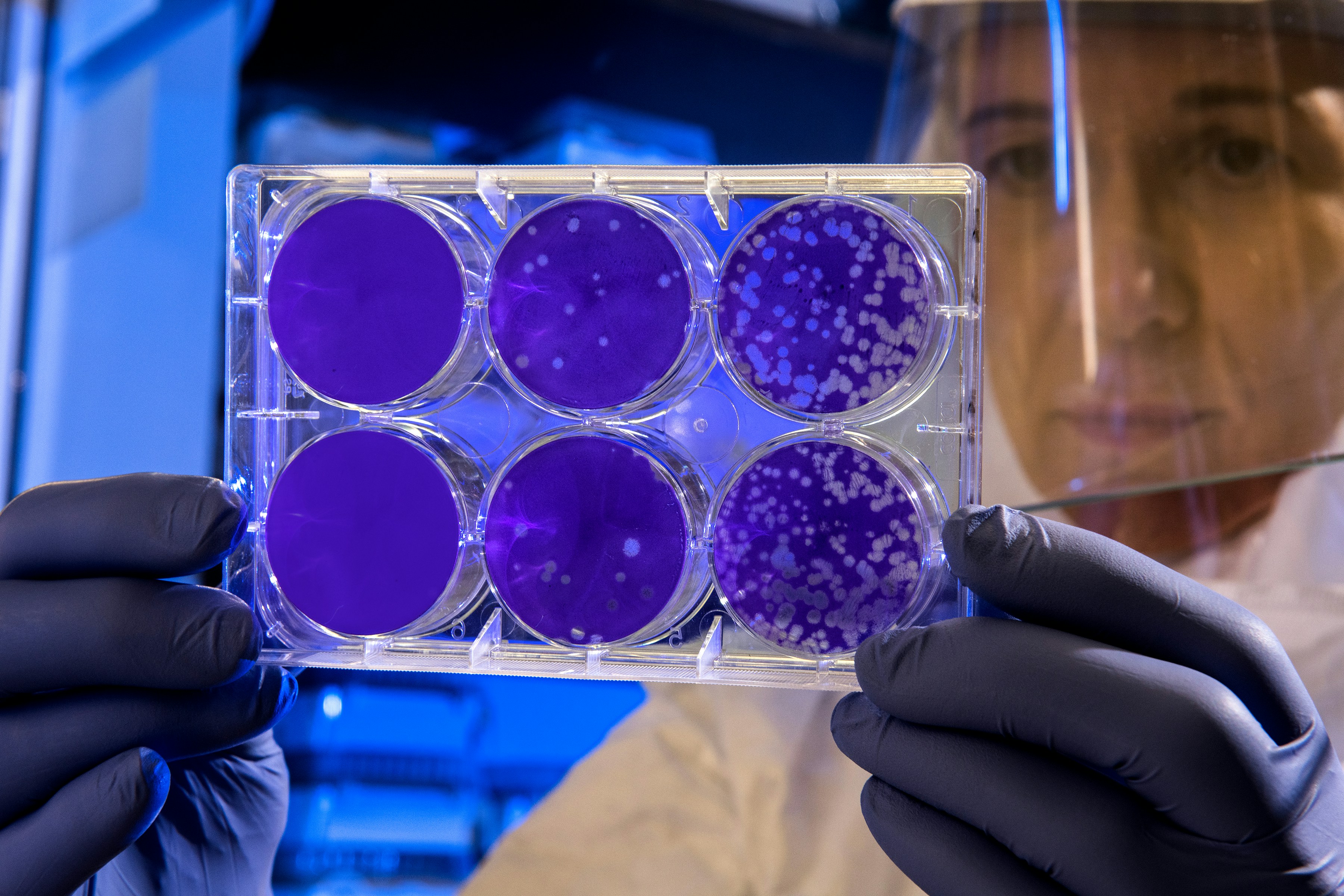 CRISPR and Gene Editing: Advancing the Future of Modern Healthcare